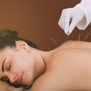 woman receiving acupuncture treatment