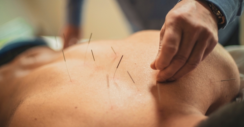 Acupuncturejpg-1 Acupuncturejpg-1